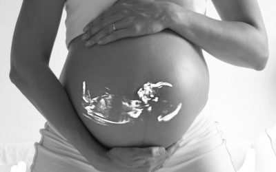Gestational Diabetes